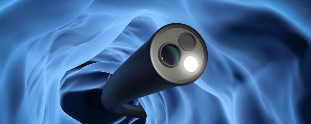 Endoscope illustration