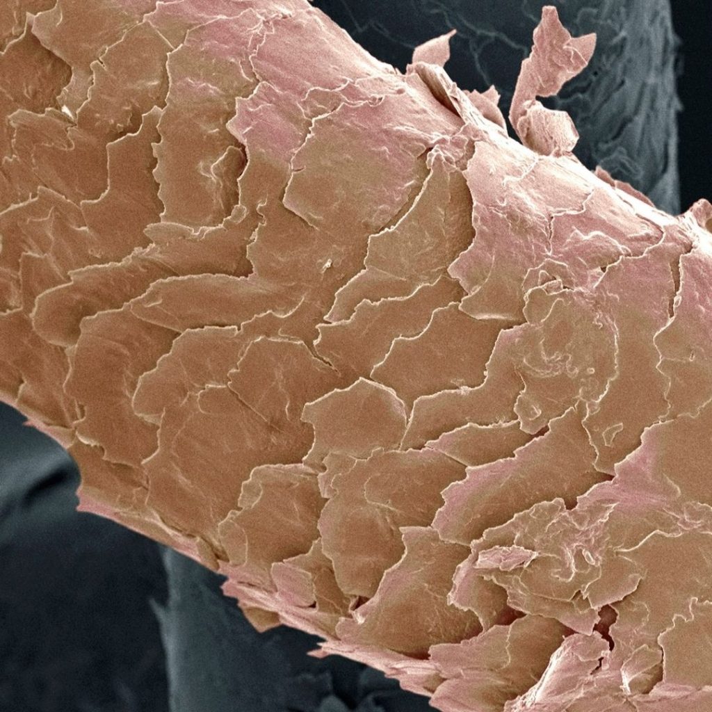cheveux au microscope