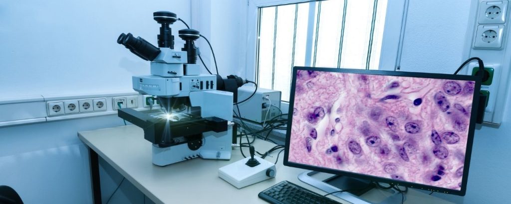 Microscope trinoculaire de recherche avec caméra connectée et visualisation sur ordinateur