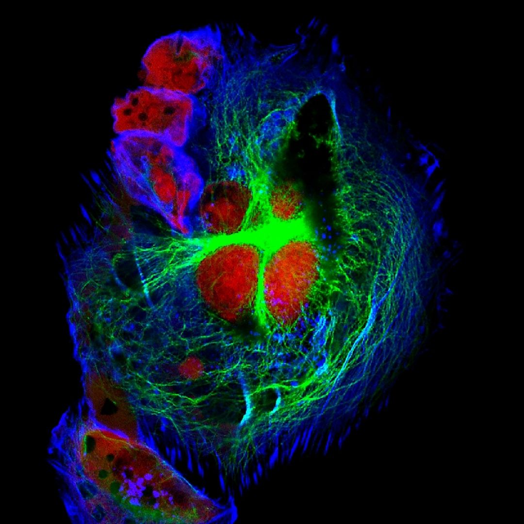 Bresser-Science-ADL image fluorescence microscope