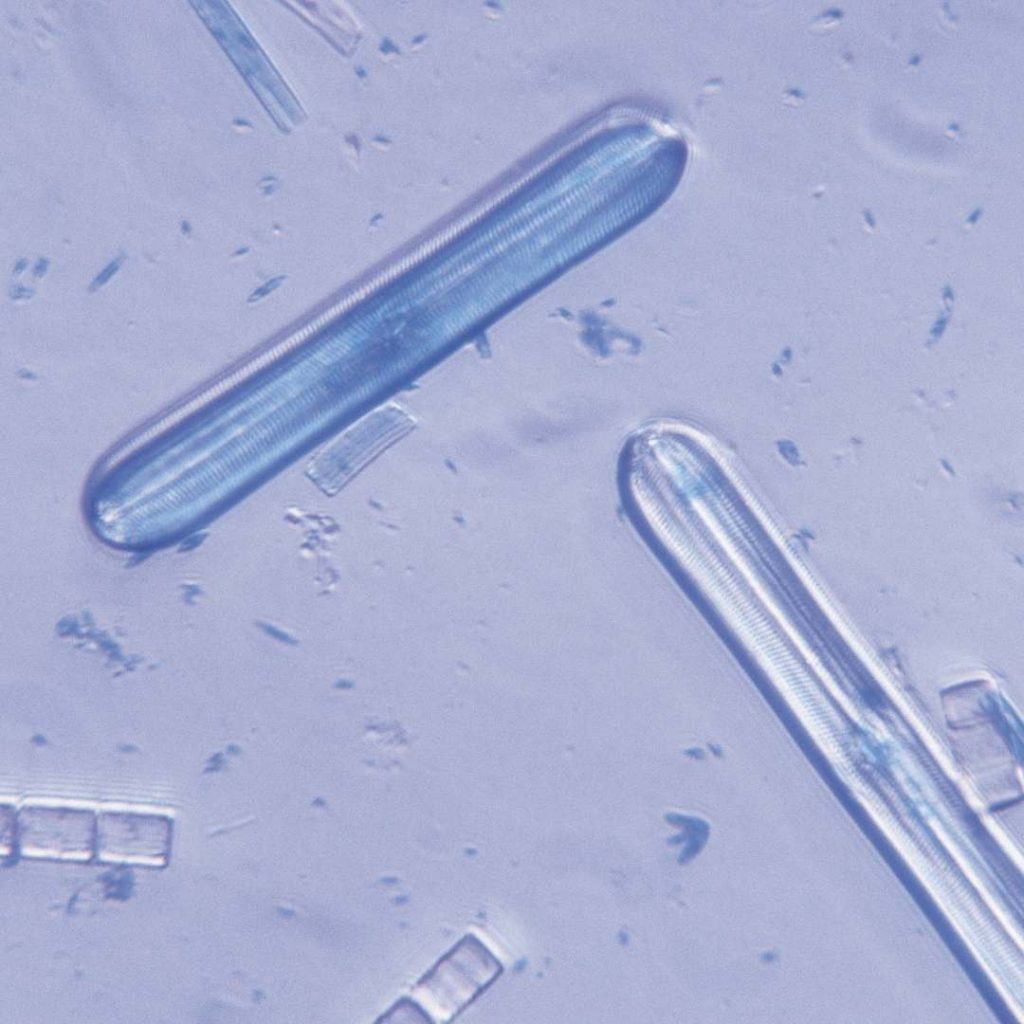Les diatomées pennées au microscope