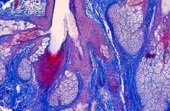 human skin under microscope