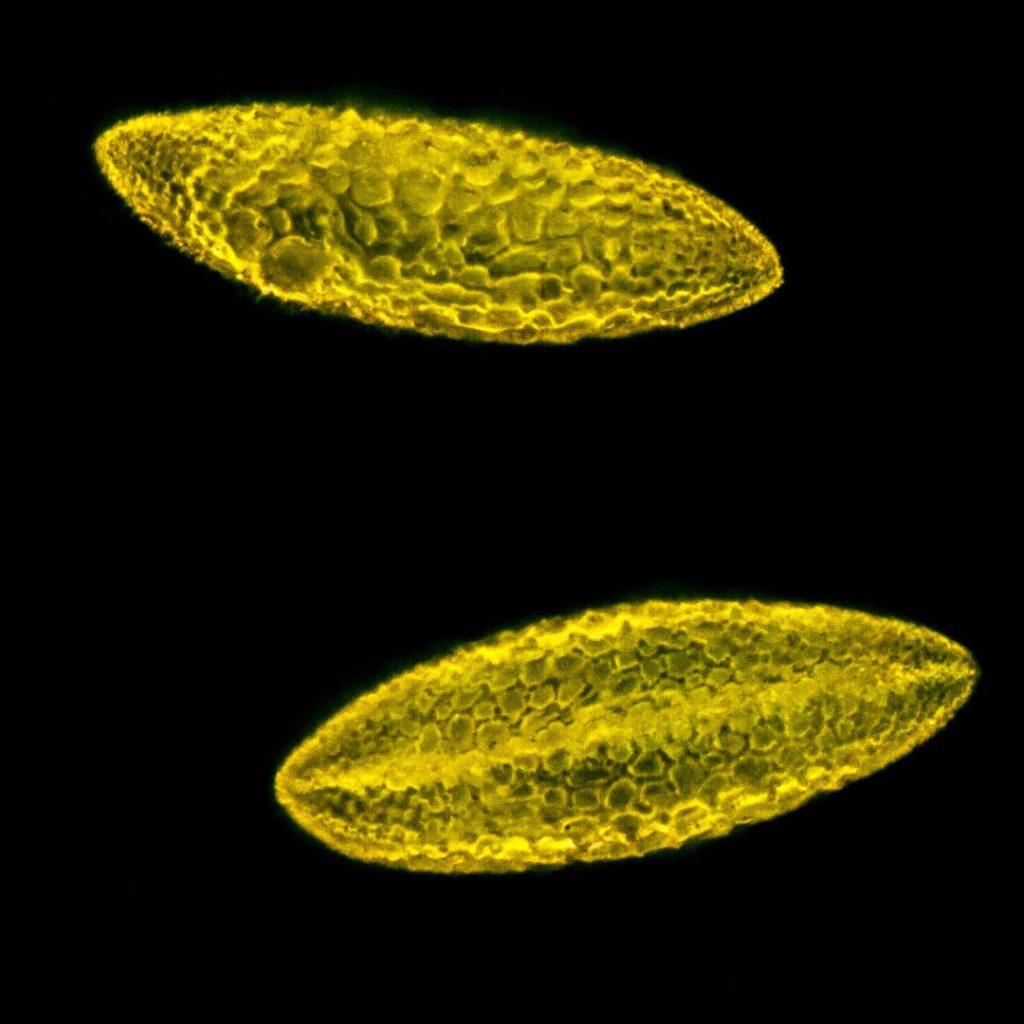 Pollen au microscope